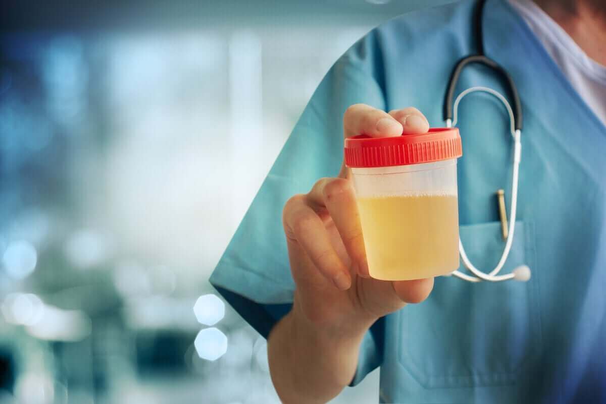 عينة بول بالمستشفى وإجراء مزرعة البول