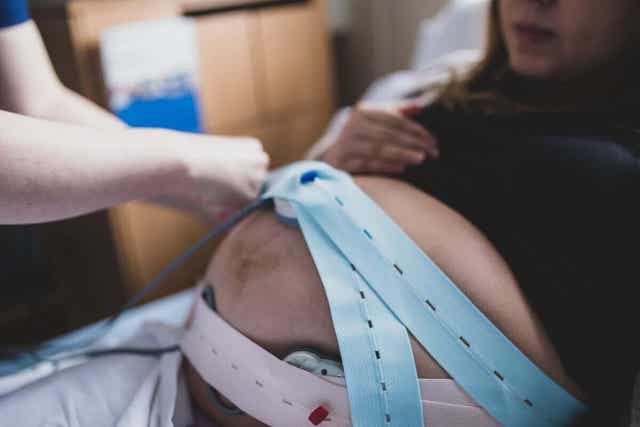 عدوى النفاس