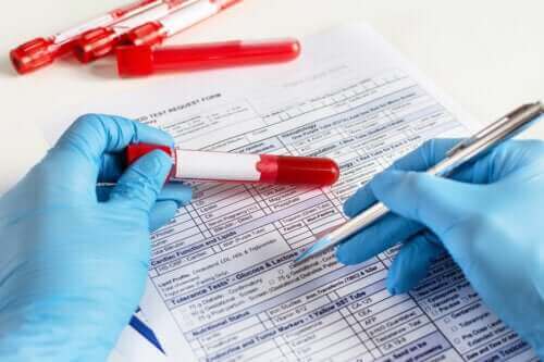 اختبار معدل ترسيب كرات الدم الحمراء: ما الذي يتكون منه الإجراء وفي ماذا يستخدم؟