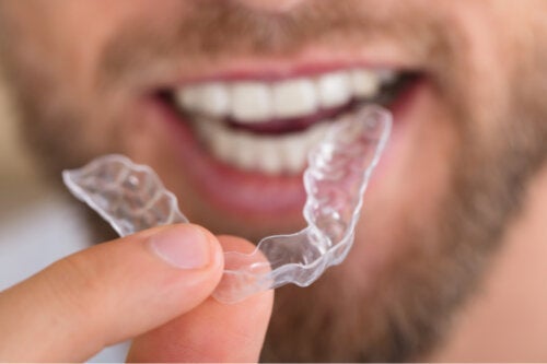 ما هي جبيرة الأسنان وما الغرض منها؟