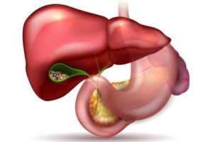 النباتات الطبية لعلاج حصوات المرارة