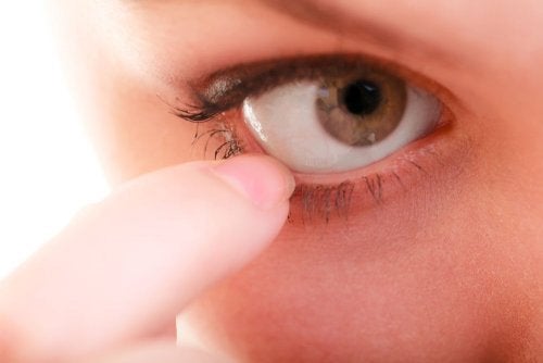 10 علاجات طبيعية لحكة العيون