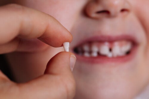 بنوك أسنان الأطفال: مصدر للخلايا الجذعية