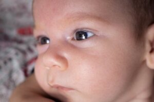 غياب القزحية: لماذا يظهر وما هي أعراضه؟