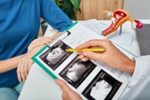 الفتق المثاني لدى النساء: الأسباب والعلاج