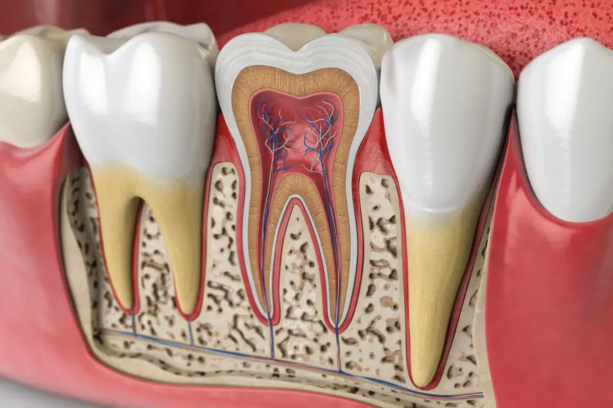 دواعم الأسنان و تصلب الأسنان