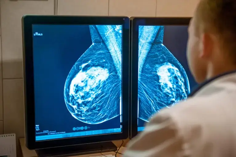 أنواع الجراحة في علاج سرطان الثدي