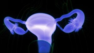 كيسات المبيض الجلدانية: الأعراض ومتى يجب زيارة الطبيب