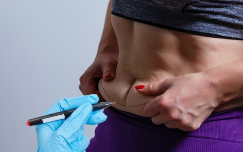 BodyTite ، تقنية لتقليل ترهل الجسم