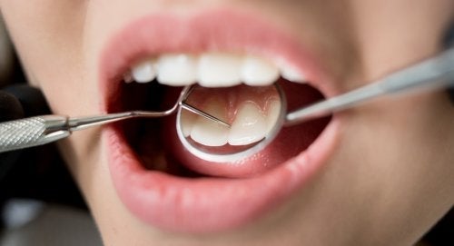 7 عواقب سوء نظافة الأسنان على صحتك
