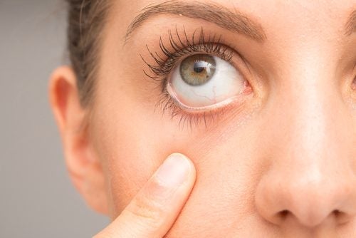 7 نصائح لعلاج اضطراب تشنج العين