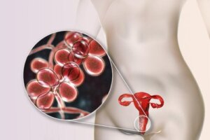 الإفرازات المهبلية الصفراء: 5 أسباب وطرق العلاج