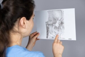ما هو ارتداد الفك السفلي وكيف يتم علاجه؟