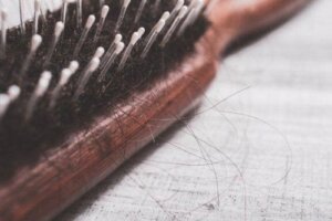 7 علاجات طبيعية لعلاج حالة الثعلبة أو تساقط الشعر